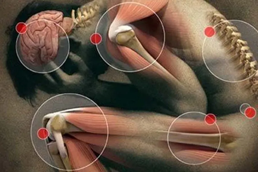 Chondrolax : تكوين المكونات الطبيعية فقط